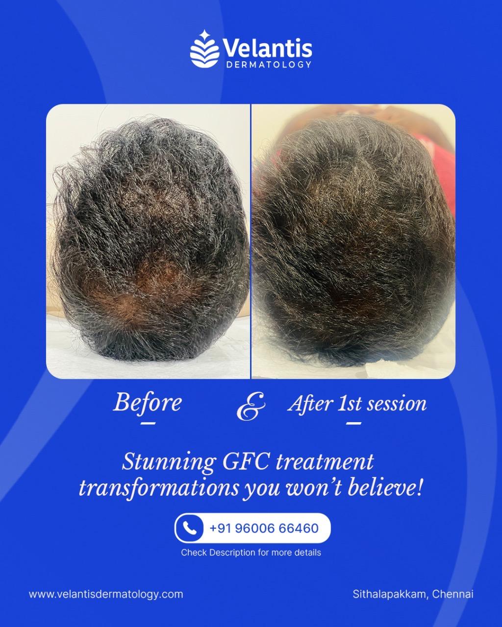 Velantis Dermatology Gallery